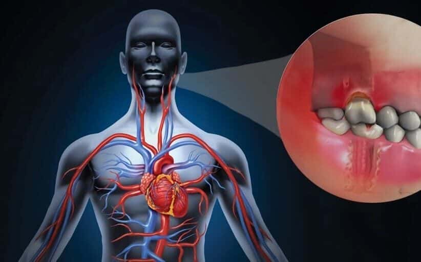 Salud bucal y su impacto en la salud cardiovascular